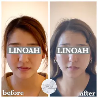 メンズ アイブロウ ビューティーサロン リノア心斎橋店のエステ・リラクイメージ