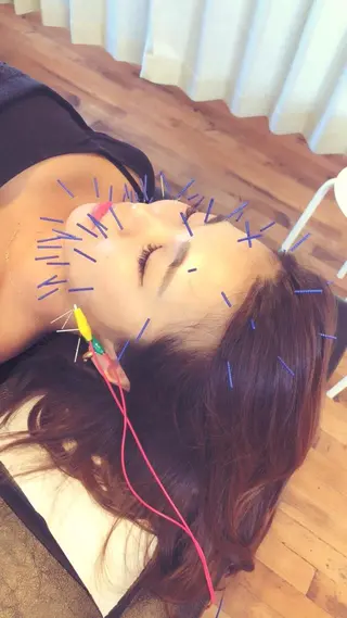 からだサロSUNNY 堺東鍼灸整骨院のエステ・リラクイメージ