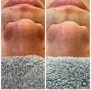 staff 山本のエステ・リラクイメージ