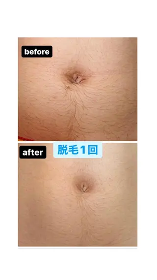脱毛・エステサロン LuLuNのエステ・リラクイメージ