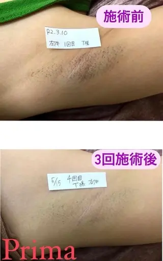 Prima（プリマ） 名古屋駅本店のエステ・リラクイメージ