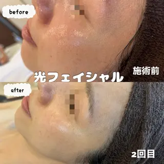 &LINO YUMIのエステ・リラクイメージ