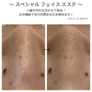 ビューティー ミロワールのエステ・リラクイメージ