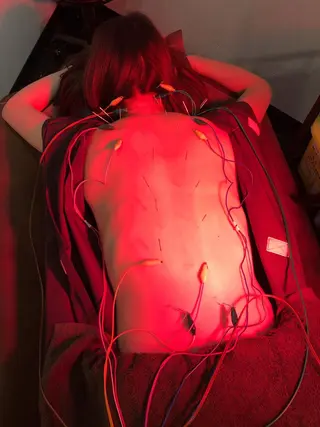 小顔矯/美容鍼/鍼灸 BeauJuのその他イメージ