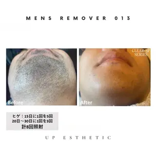 メンズ 韓国肌管理 ウプエステティックのエステ・リラクイメージ