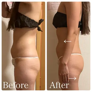 🌴Beauty Salon LANAのエステ・リラクイメージ