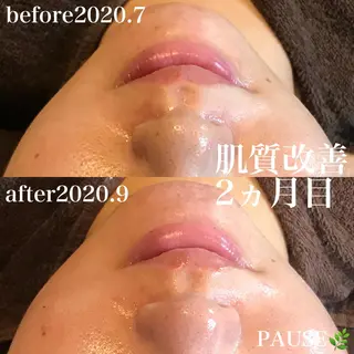 浜野 恵美のエステ・リラクイメージ