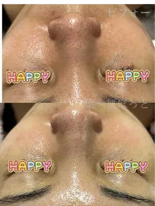 うえつま ふみえのエステ・リラクイメージ