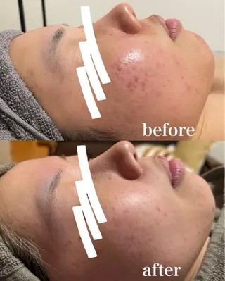 瀧野 史園のエステ・リラクイメージ