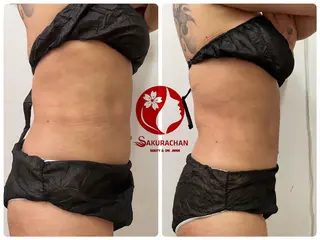 美肌，美ボディ，脱毛 サクラチャンスパのエステ・リラクイメージ