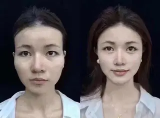 マツエク・マツパ aliaハーブ水光店 エステティシャン募集のエステ・リラクイメージ