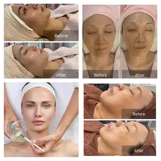 Lis Rose🥀 フェイシャルサロンのエステ・リラクイメージ