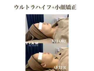 美肌サロンTIAM by tetoteのエステ・リラクイメージ