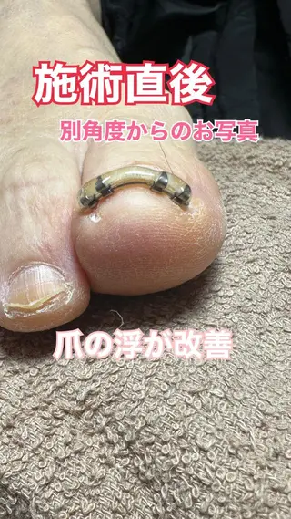 ネイル ○△□ 守口市のネイルデザイン