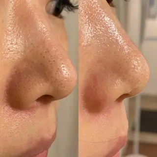 よもぎ蒸し専門店 Artemisiaのエステ・リラクイメージ