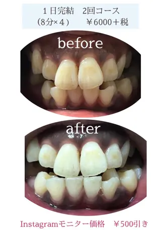 石谷 詩織のネイルデザイン