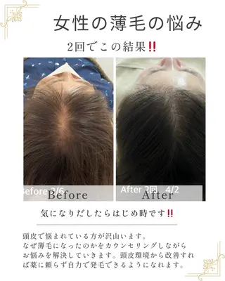 メンズ キッズ 美肌脱毛エステサロン Luangeのエステ・リラクイメージ