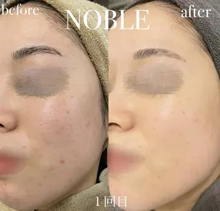 NOBLE 新宿本店のエステ・リラクイメージ