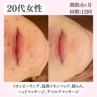 ニキビ・肌質改善専門 ♡人生が変わるサロンのエステ・リラクイメージ