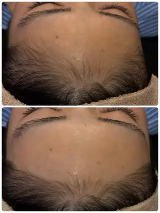 Dione 立川店のエステ・リラクイメージ