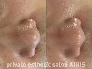 AIRIS 船橋店のエステ・リラクイメージ