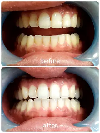 mindplus(マインドプラス)所属・mind plus 【小顔　痩身　脱毛】のエステ・リラクイメージ