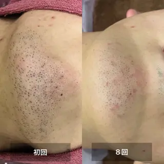 美肌，美ボディ，脱毛 サクラチャンスパのエステ・リラクイメージ