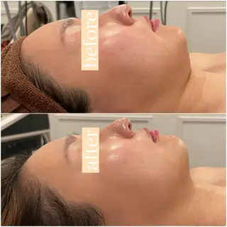 立体小顔×艶肌×美ボ ディ似合わせ施術 岡のエステ・リラクイメージ