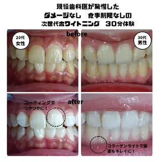 キッズ メンズ 美ろく　トータルビューティーサロン所属・セルフホワイトニング メーカー直営サロンのエステ・リラクイメージ