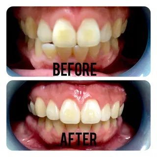 two nailのネイルデザイン