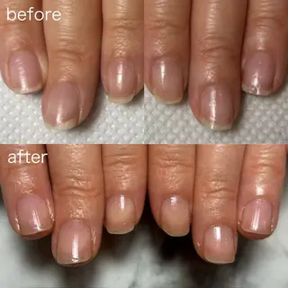 ネイル 自爪育成/深爪矯正salon fam_【ネイルケア・エステ脱毛】所属・自爪育成/深爪矯正 salon fam_のネイルデザイン