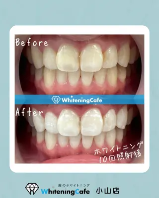 ホワイトニングカフェ 小山店のエステ・リラクイメージ