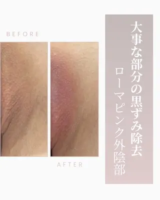 Raviy 【痩身専門・肌管理】のエステ・リラクイメージ