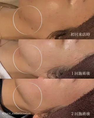 Luca所属・Luca 痩身• 疲労改善×韓国肌管理のエステ・リラクイメージ