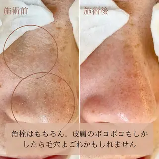 Mimi所属・大人のエステケア専門 ／ココニのエステ・リラクイメージ