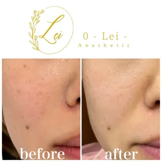 レイエステティック スタッフのエステ・リラクイメージ