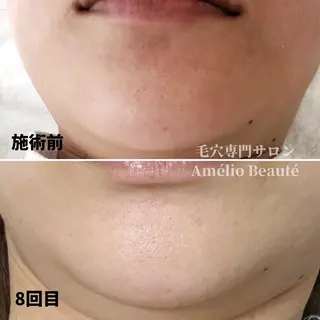 毛穴ケア専門サロン アメリオボーテのその他イメージ