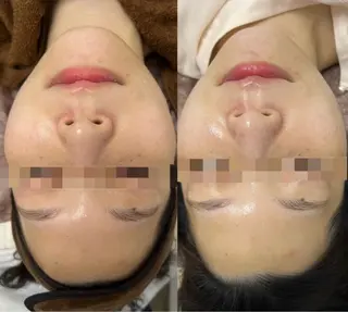 毛穴レス美肌へ🌿 看護師Abe🌼のエステ・リラクイメージ