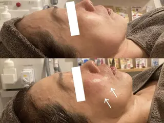 CHERIE Akaneのエステ・リラクイメージ