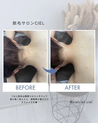 脱毛サロン CIELのエステ・リラクイメージ