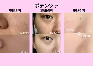 ショート aliaハーブ水光店 エステティシャン募集のエステ・リラクイメージ