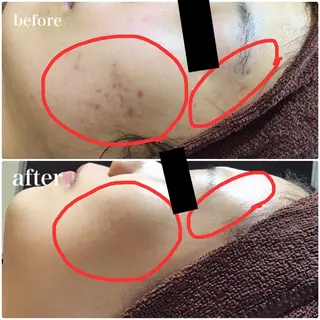 IMPACT所属・IMPACT 💎のエステ・リラクイメージ