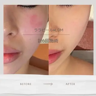 Life Salon別府店のエステ・リラクイメージ