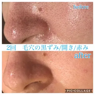 ミディアム カラー パーマ ヘアアレンジ メンズ キッズ ネイル マツエク・マツパ EnsorClair 代表　野口真央のエステ・リラクイメージ