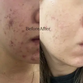 Ginza Charerのエステ・リラクイメージ