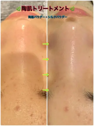 Dione 立川店のエステ・リラクイメージ