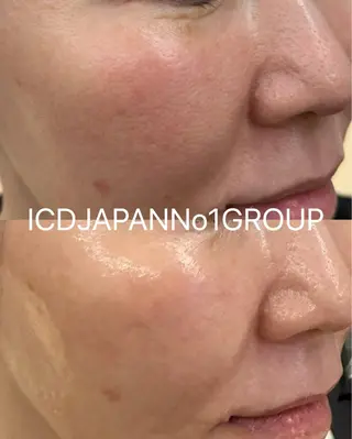 看護師 AYUIのエステ・リラクイメージ