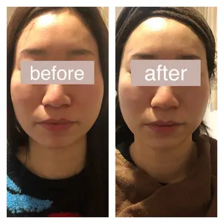 毛穴ニキビ専門 ビューティーグランツのエステ・リラクイメージ