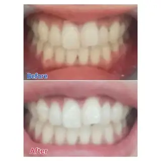 M渋谷 ホワイトニングのエステ・リラクイメージ