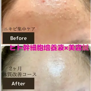 gomi sayakaのエステ・リラクイメージ